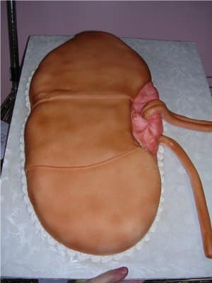 louisefkidney